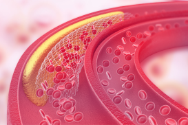 Behandeling van hypercholesterolemie - Volgens de meest recente ESC/EAS-richtlijnen
